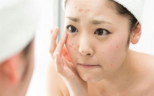 Cẩm Nang Dùng Mỹ Phẩm Dành Cho Tuổi Dậy Thì