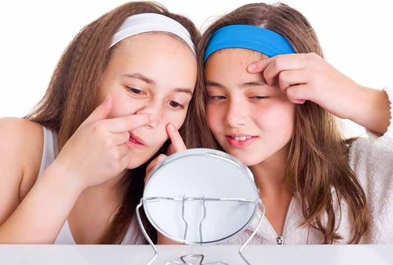 Nên hay không nên sử dụng sản phẩm chăm sóc da tuổi dậy thì?