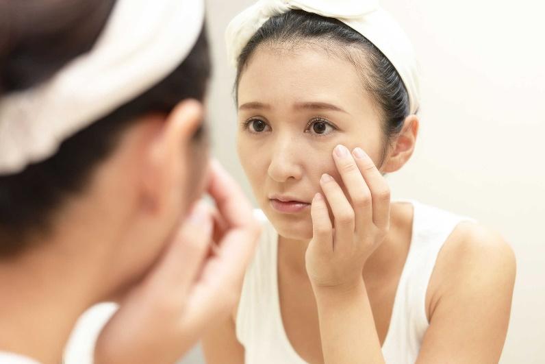 Giải Đáp Các Câu Hỏi Thường Gặp Về Da Mẫn Cảm (P2)