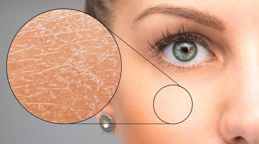 Hướng Dẫn Cách Dưỡng Ẩm Lành Tính Với Từng Loại Da (P2)