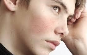 Điều Trị Da Nhạy Cảm Như Thế Nào Cho Đúng Cách?