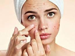 Nếu không chăm sóc và bảo vệ da đúng cách thì da dễ xuất hiện các kích ứng