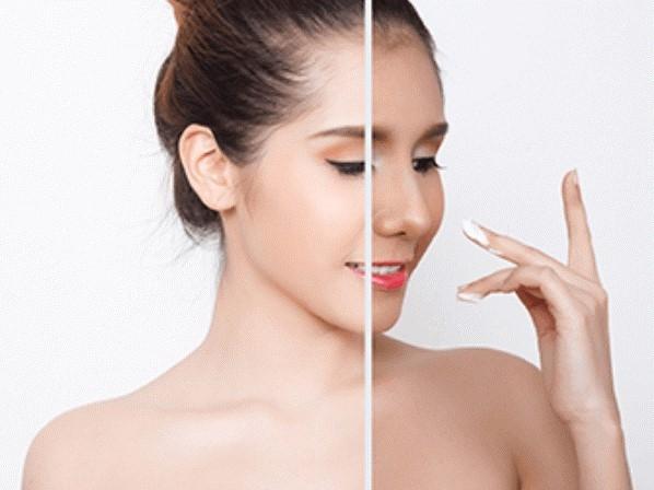 Lotion Và Kem Dưỡng Ẩm Cho Da Hỗn Hợp Thiên Dầu
