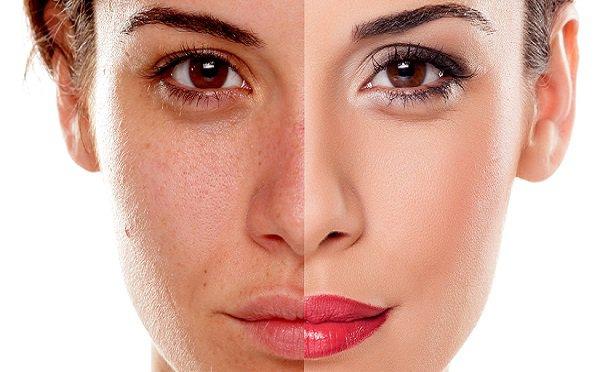 Chọn Lotion Cho Da Khô Nhạy Cảm Như Thế Nào?