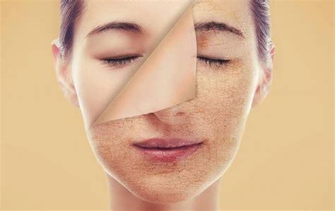 Hàng rào bảo vệ da có thể bị suy yếu do thiếu độ ẩm