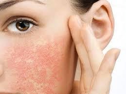 Tìm hiểu đầy đủ về kem dưỡng da cho da dầu nhạy cảm