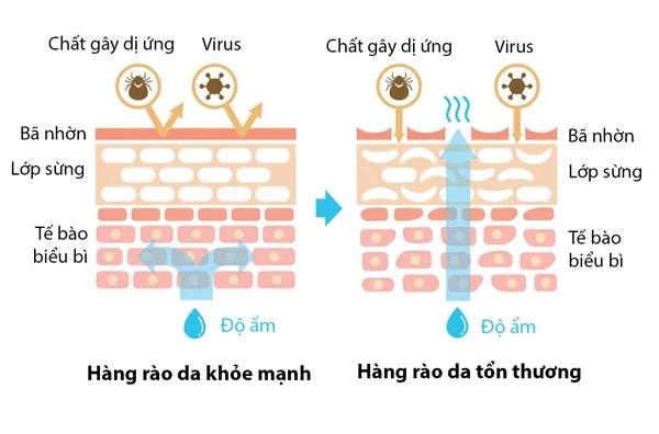 Hiệu quả chăm sóc của kem dưỡng da cho da dầu nhạy cảm