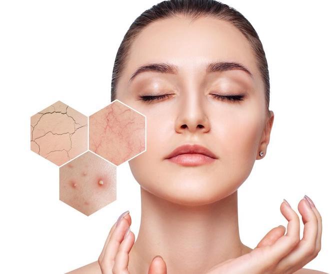 Vì sao bạn nên dùng sửa rửa mặt cho da mụn nhạy cảm